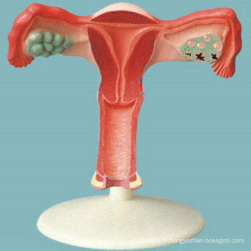 Modèle d&#39;anatomie médicale de l&#39;utérus naturel agrandi pour l&#39;enseignement (R110212)